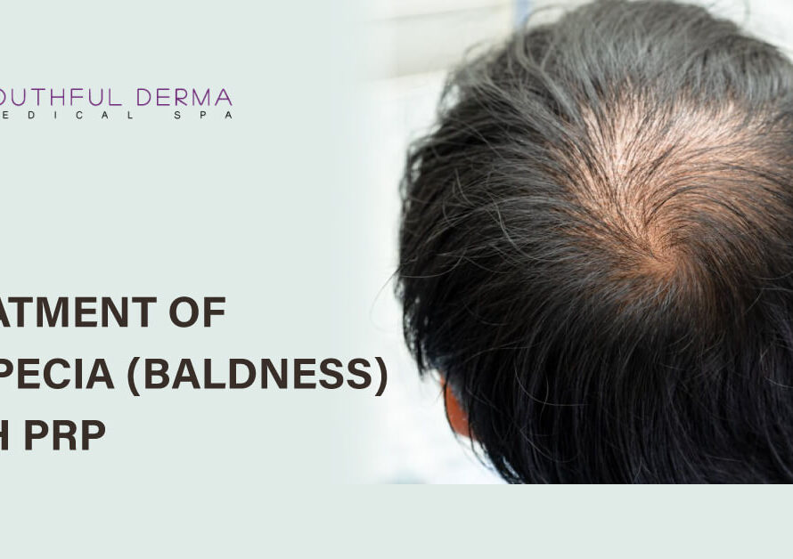 Treatment of Alopecia (Baldness) with PRP