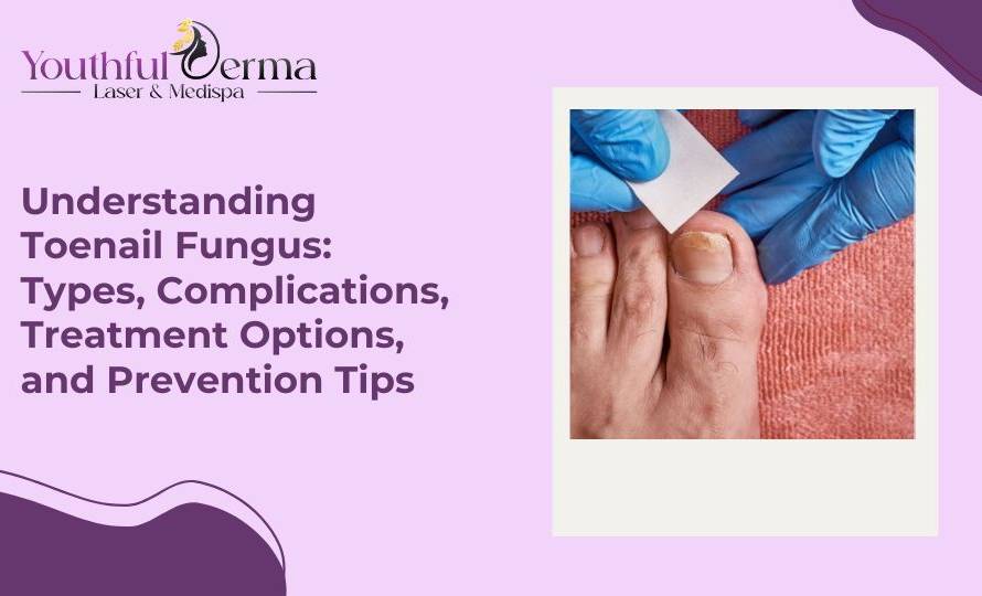 Toenail Fungus: Types, Complications, Treatment Options, and Prevention Tips